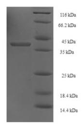 SDS-PAGE (RAD52-957S).jpg